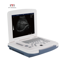 MT Medical china cheapest portable ultrasound machine
